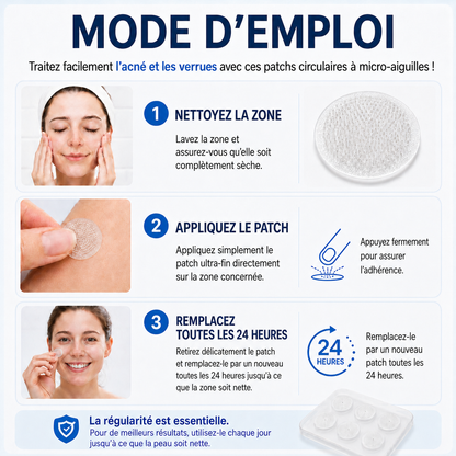 👩‍⚕️🎁 𝐵𝑜𝑢𝑡𝑖𝑞𝑢𝑒 𝑂𝑓𝑓𝑖𝑐𝑖𝑒𝑙𝑙𝑒 | 𝑵𝐞𝒌𝐢𝐬𝐬® 🌿𝑴𝒊𝒄𝒓𝒐𝒏𝒆𝒆𝒅𝒍𝒆𝒔 𝑷𝒆𝒂𝒖 𝑷𝒂𝒓𝒇𝒂𝒊𝒕𝒆 É𝒍𝒊𝒎𝒊𝒏𝒂𝒕𝒊𝒐𝒏 𝑫𝒆𝒔 𝑽𝒆𝒓𝒓𝒖𝒆𝒔 𝑷𝒂𝒕𝒄𝒉 (𝑃𝑜𝑢𝑟 𝑙𝑒𝑠 𝑎𝑐𝑟𝑜𝑐ℎ𝑜𝑟𝑑𝑜𝑛𝑠, 𝑙𝑒𝑠 𝑝𝑒𝑡𝑖𝑡𝑒𝑠 𝑒𝑥𝑐𝑟𝑜𝑖𝑠𝑠𝑎𝑛𝑐𝑒𝑠 𝑐𝑢𝑡𝑎𝑛é𝑒𝑠, 𝑙𝑒𝑠 𝑣𝑒𝑟𝑟𝑢𝑒𝑠, 𝑙𝑒𝑠 𝑔𝑟𝑎𝑖𝑛𝑠 𝑑𝑒 𝑏𝑒𝑎𝑢𝑡é, 𝑙𝑒𝑠 𝑡𝑎𝑐ℎ𝑒𝑠 𝑑𝑒 𝑣𝑖𝑒𝑖𝑙𝑙𝑒𝑠𝑠𝑒 𝑒𝑡 𝑙𝑒𝑠 𝑝𝑟𝑜𝑏𝑙è𝑚𝑒𝑠 𝑑𝑒 𝑝𝑖𝑔𝑚𝑒𝑛𝑡𝑎𝑡𝑖𝑜𝑛)